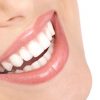 A Quick Note On Laser Teeth Whitening