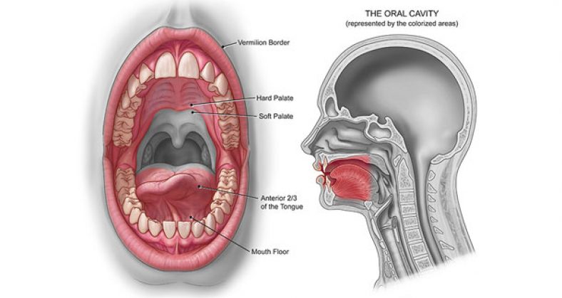 Oral Cancer