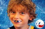 Mouth Guards In Sports – Most Important and Necessary Equipment For Every Athlete!