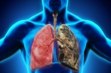 Overview On Lungs Disease